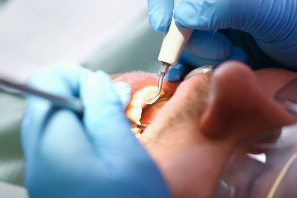 Best Emergency Root Canal Treatment in Reedurban, OH