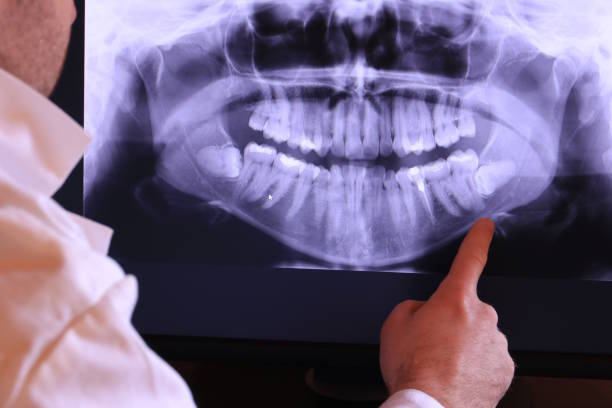 Best Broken or Cracked Tooth Emergency Dentist in Reedurban, OH